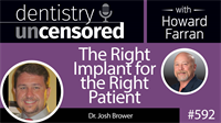 592 The Right Implant for the Right Patient with Josh Brower : Dentistry Uncensored with Howard Farran