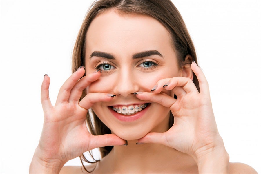 Getting Braces - Here are The Top 10 Things to Know 