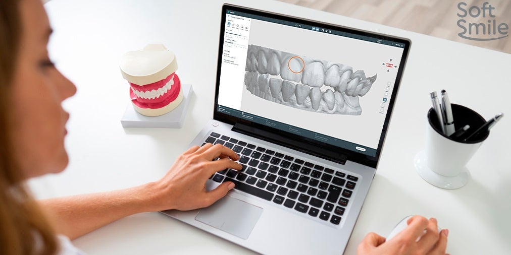 Three Ways AI is Transforming the Dental Aligner Market
