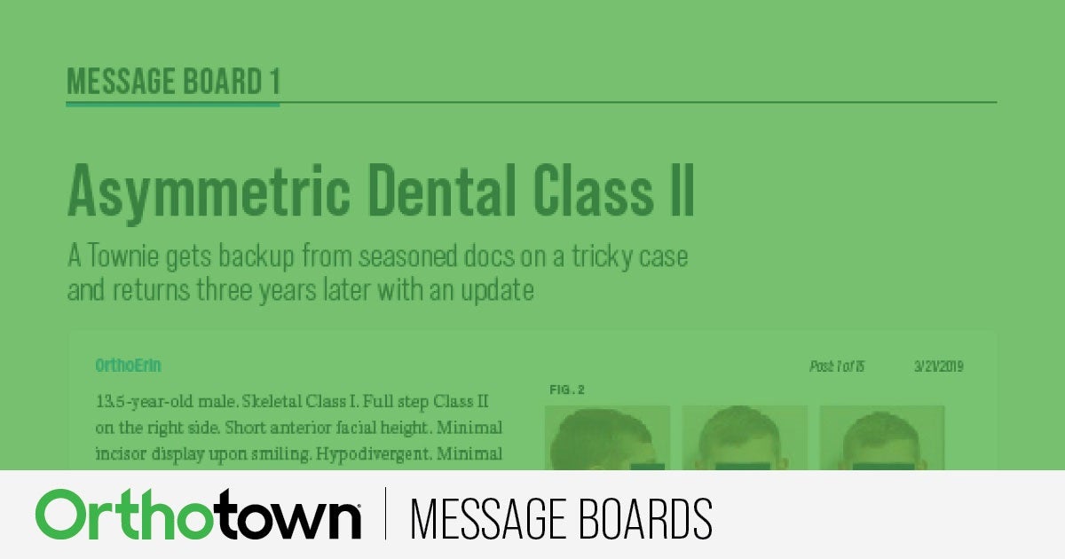 Asymmetric Dental Class II
