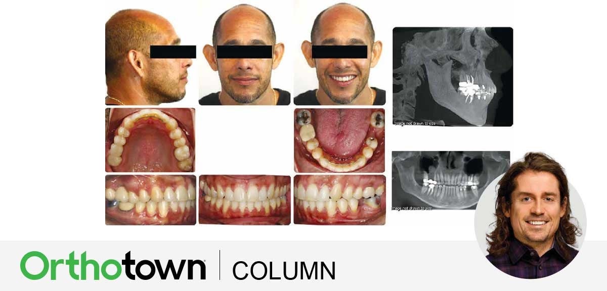 A Voice in the Arena: The Importance of Timing IPR