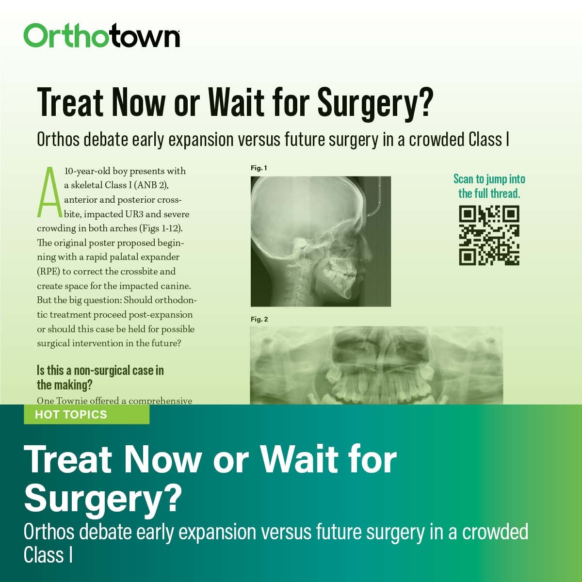 Treat Now or Wait for Surgery?
