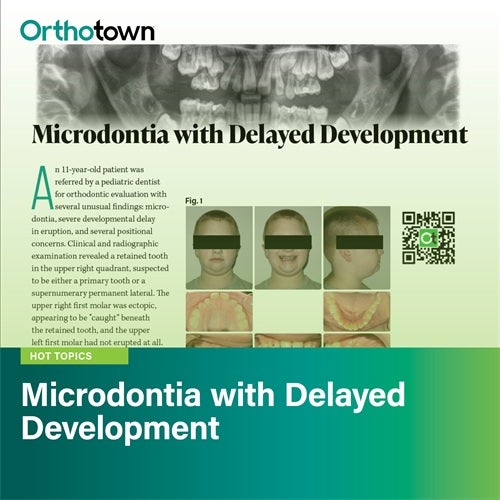 Straight Talk: Microdontia with Delayed Development  Townies discuss an 11-year-old patient with microdontia, delayed eruption, crossbite, and a suspected supernumerary tooth. 